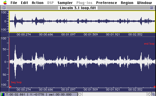 Waveform of an unborn baby's pulse